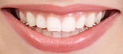 Статья. Что портит зубы, от чего портятся зубы, разрушаются зубы, здоровые зубы